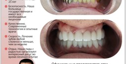  Лечение зубов в Китае, без страха и боли всего за 4 дня